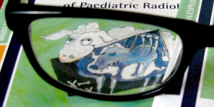 ESPR 2018 – Strahlendosis pädiatrischer Traumapatienten in London sinkt
