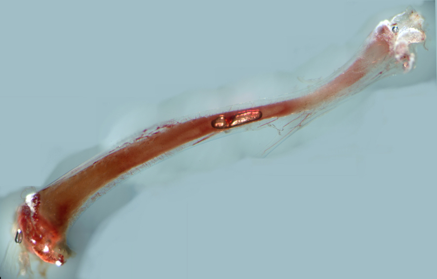 Feinste Blutgefäße verbinden das Knochenmark direkt mit der Knochenhaut (©UDE/M. Gunzer, A. Grüneboom)