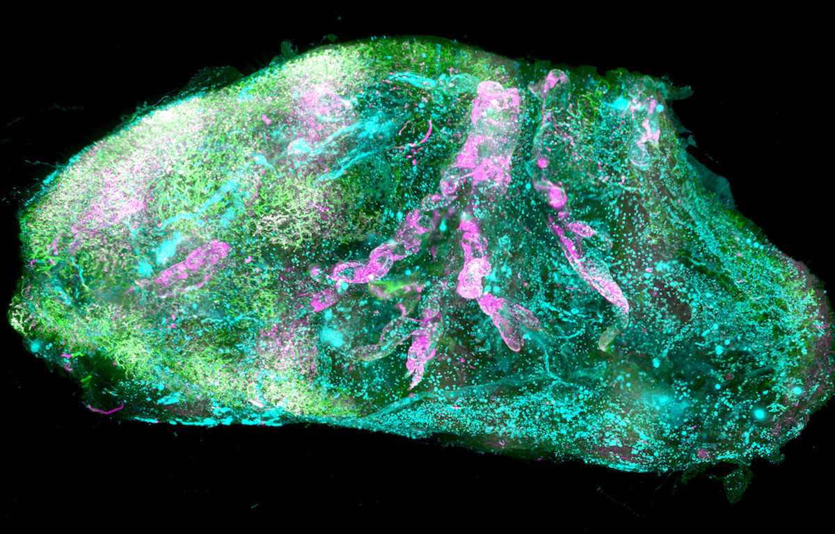Vaskuläre und Glomeruli-Details der menschlichen Niere (©Helmholtz Zentrum München / Ertürk Lab)