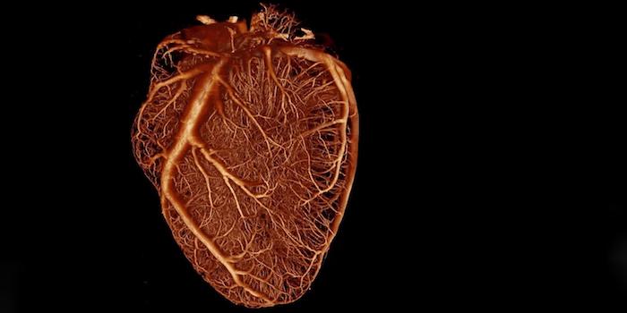 Konsensuserklärung zu bildgebenden Verfahren bei ischämischen Herzerkrankungen