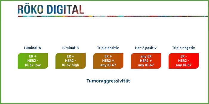 RöKo Digital – Mamma-MRT: Stellenwert beim Brustkrebs-Screening