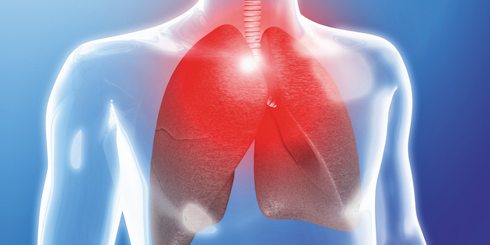 IQWiG: Nutzen von Lungenkrebsscreening größer als möglicher Schaden