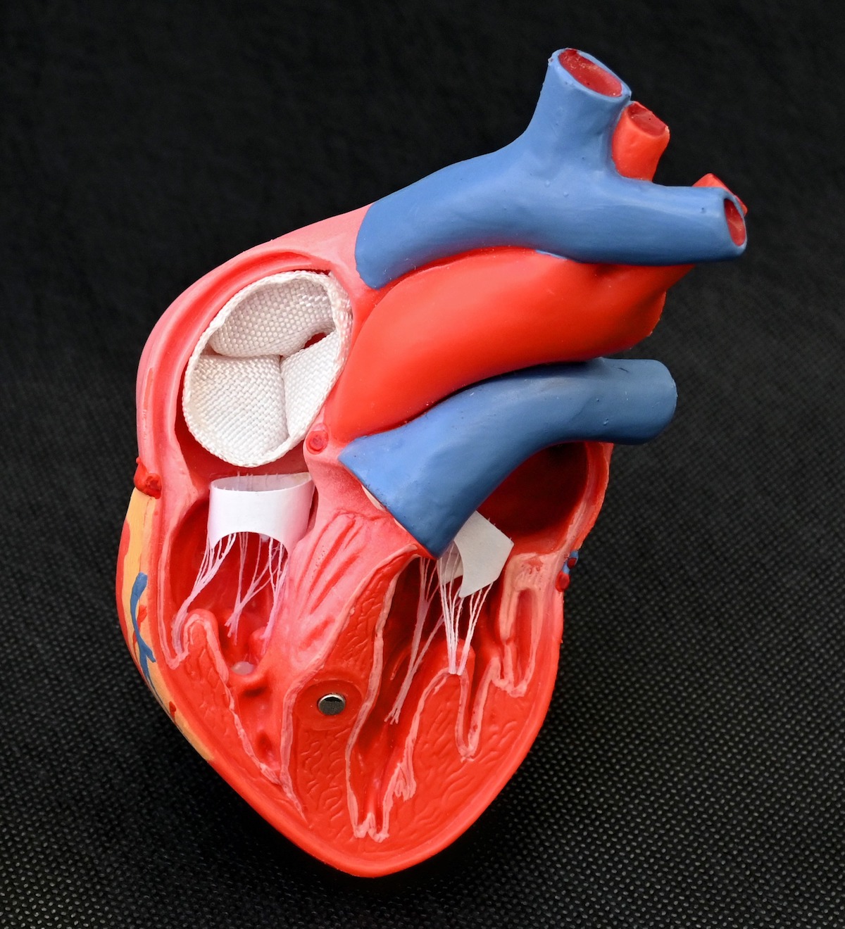 Weiß: webtechnisch gefertigte Herzklappenprothesen (©ITM_TUD)