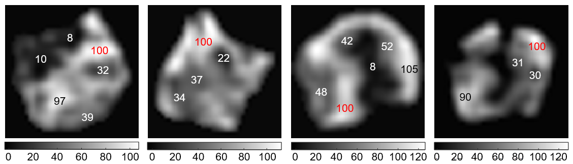 Die MRT-Scans der ETH-Forschenden zeigen numerisch, wie viel Myelin an einer bestimmten Stelle im Vergleich zu anderen Bereichen des Bildes vorhanden ist.